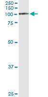5 - FAP Antibody (monoclonal) (M01) AT1998a