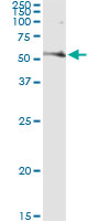 5 - FASN Antibody (monoclonal) (M01) AT2002a