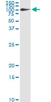 5 - FBLN1 Antibody (monoclonal) (M01) AT2009a