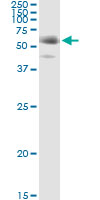 5 - FGL2 Antibody (monoclonal) (M01) AT2042a