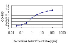 10 - FLJ10597 Antibody (monoclonal) (M01) AT2062a
