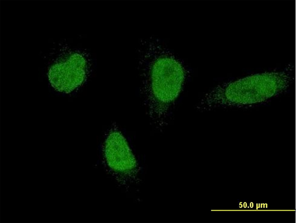 3 - FLJ10597 Antibody (monoclonal) (M01) AT2062a