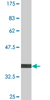 1 - FLJ10986 Antibody (monoclonal) (M04) AT2063a