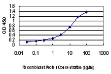 10 - FLJ20643 Antibody (monoclonal) (M06) AT2068a