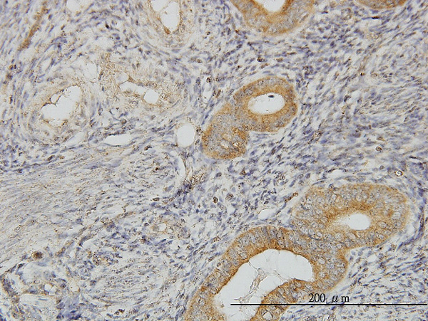 2 - FLJ20643 Antibody (monoclonal) (M06) AT2068a
