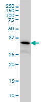 1 - FLJ20643 Antibody (monoclonal) (M06) AT2068a