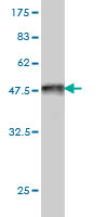 1 - FLJ23749 Antibody (monoclonal) (M01) AT2070a