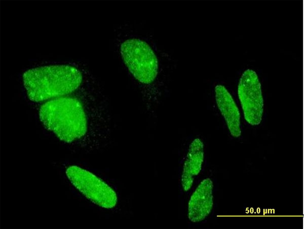 3 - FLJ23834 Antibody (monoclonal) (M03) AT2071a