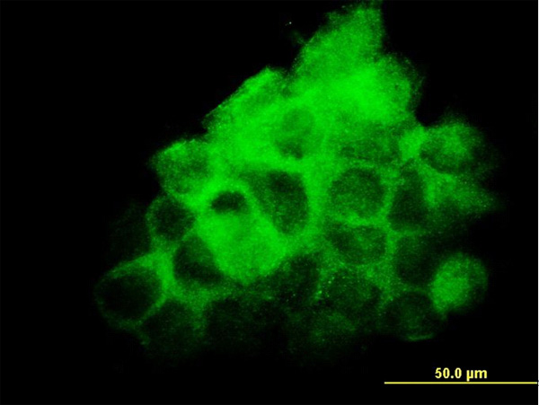 3 - FNDC3A Antibody (monoclonal) (M01) AT2079a