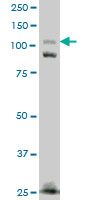 1 - FNDC3A Antibody (monoclonal) (M01) AT2079a