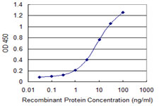 10 - FOXJ2 Antibody (monoclonal) (M06) AT2095a