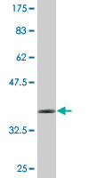 1 - FOXJ2 Antibody (monoclonal) (M06) AT2095a