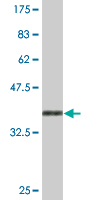 1 - FOXP4 Antibody (monoclonal) (M01) AT2103a