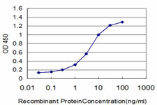 10 - FOXQ1 Antibody (monoclonal) (M01) AT2104a