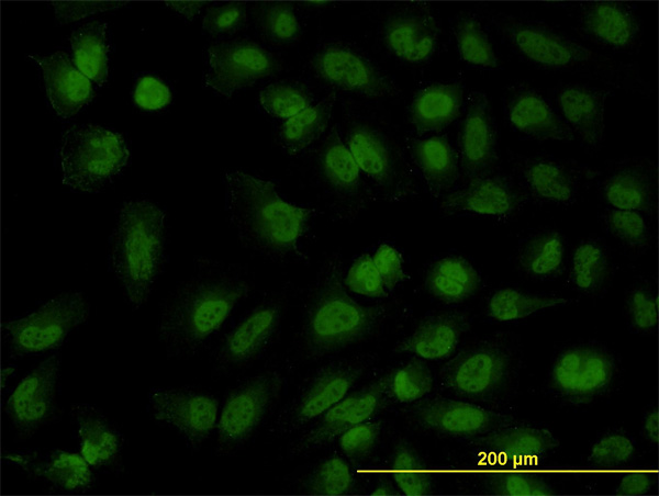 3 - FOXR2 Antibody (monoclonal) (M01) AT2106a