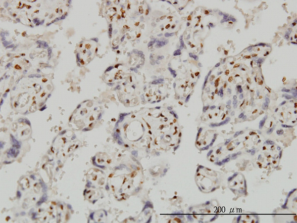 2 - FOXR2 Antibody (monoclonal) (M01) AT2106a