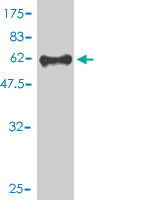 1 - FOXR2 Antibody (monoclonal) (M01) AT2106a