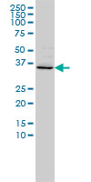 1 - FOXR2 Antibody (monoclonal) (M01) AT2106a