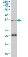 1 - FUSIP1 Antibody (monoclonal) (M03) AT2120a
