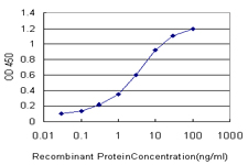 10 - FUSIP1 Antibody (monoclonal) (M03) AT2120a