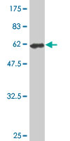 1 - FVT1 Antibody (monoclonal) (M01) AT2126a