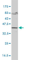 1 - FVT1 Antibody (monoclonal) (M01) AT2126a