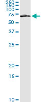 5 - FZD5 Antibody (monoclonal) (M01) AT2131a