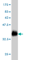 1 - GALNT6 Antibody (monoclonal) (M01) AT2147a