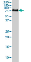 1 - GALNT6 Antibody (monoclonal) (M01) AT2147a