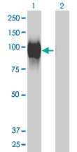1 - GALNT6 Antibody (monoclonal) (M01) AT2147a