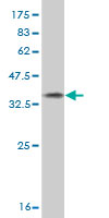 1 - GATAD2A Antibody (monoclonal) (M01) AT2164a