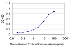 10 - GATAD2B Antibody (monoclonal) (M01) AT2165a
