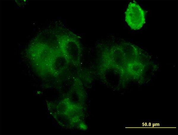 3 - GCA Antibody (monoclonal) (M01) AT2171a