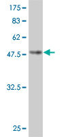 1 - GCA Antibody (monoclonal) (M01) AT2171a