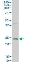 1 - GCA Antibody (monoclonal) (M01) AT2171a