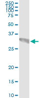 5 - GCH1 Antibody (monoclonal) (M01) AT2174a