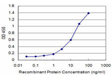 10 - GEMIN6 Antibody (monoclonal) (M08) AT2189a