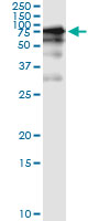 5 - GGT1 Antibody (monoclonal) (M01) AT2197a