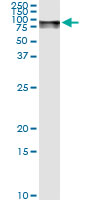 5 - GLB1 Antibody (monoclonal) (M01) AT2205a