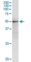 5 - GMPPA Antibody (monoclonal) (M01) AT2221a