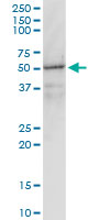1 - GNAI1 Antibody (monoclonal) (M01) AT2225a