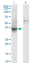 1 - GNAI1 Antibody (monoclonal) (M01) AT2225a