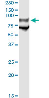5 - GP1BA Antibody (monoclonal) (M02) AT2241a