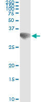 5 - GSC Antibody (monoclonal) (M01) AT2267a