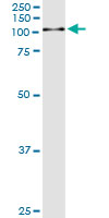 5 - GSN Antibody (monoclonal) (M01) AT2272a