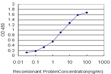 10 - GSTM5 Antibody (monoclonal) (M02) AT2281a