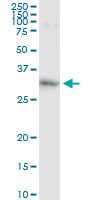 5 - GSTO1 Antibody (monoclonal) (M01) AT2282a