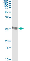5 - GSTP1 Antibody (monoclonal) (M01) AT2283a