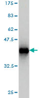 1 - GTF2IRD1 Antibody (monoclonal) (M01) AT2291a