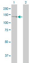 1 - GTF2IRD1 Antibody (monoclonal) (M01) AT2291a